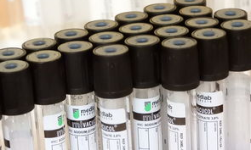 微生物学排名究竟是怎样确定的？有啥参考价值？